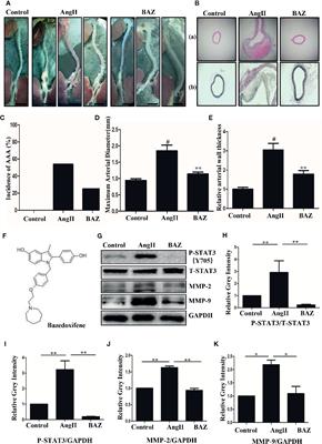 Bazedoxifene Attenuates Abdominal Aortic Aneurysm Formation via Downregulation of Interleukin-6/Glycoprotein 130/Signal Transducer and Activator of Transcription 3 Signaling Pathway in Apolipoprotein E–Knockout Mice